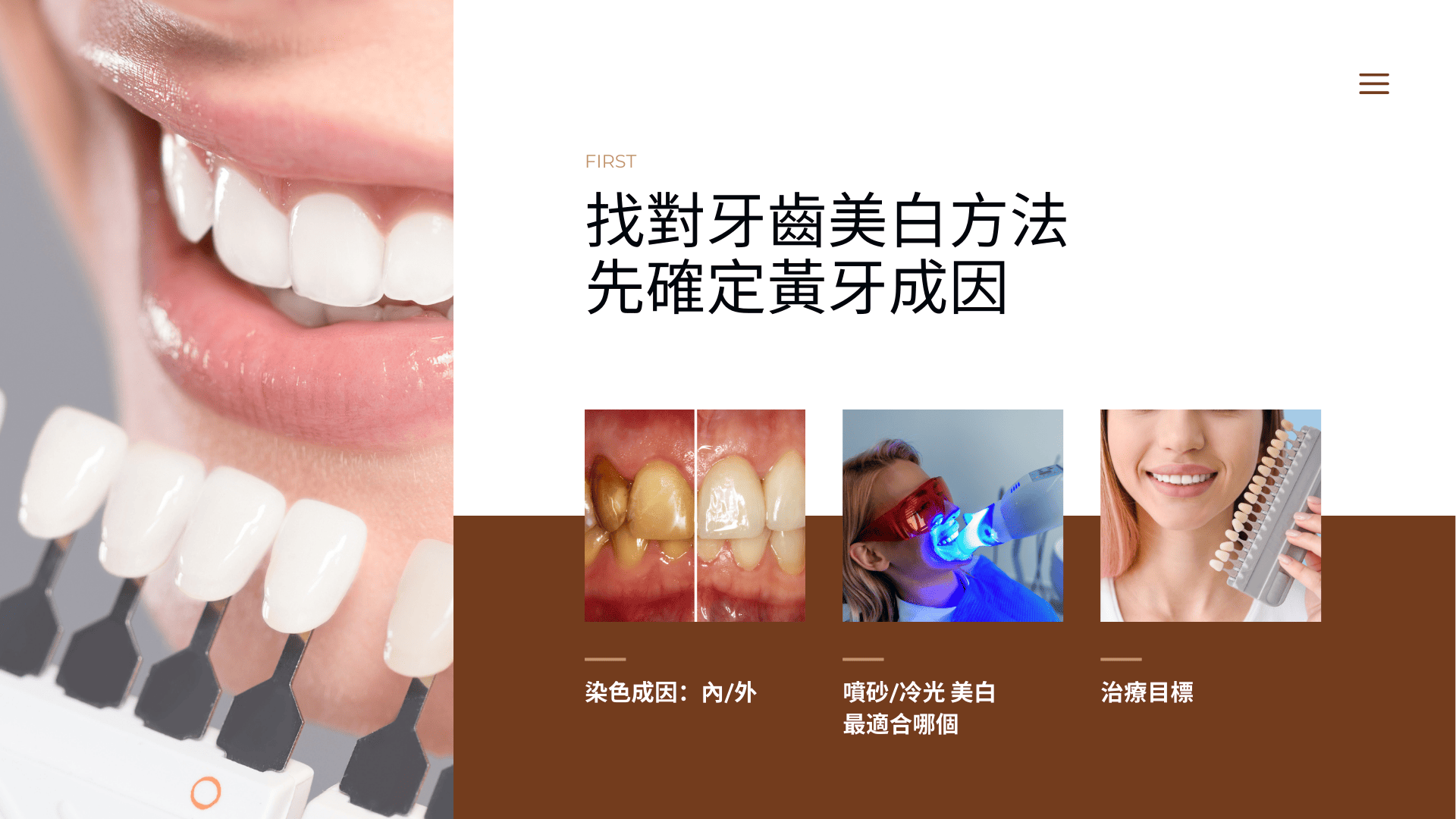 找對牙齒美白方法，先確定黃牙成因